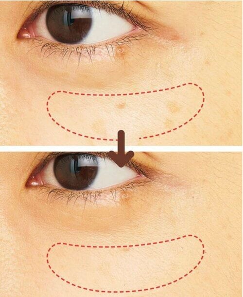 隠したいところに塗って自然に見せる、コンシーラー! コンシーラーおすすめ イメージ