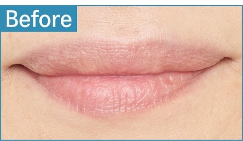 黄み肌／厚め唇 色つきリップクリームおすすめ イメージ