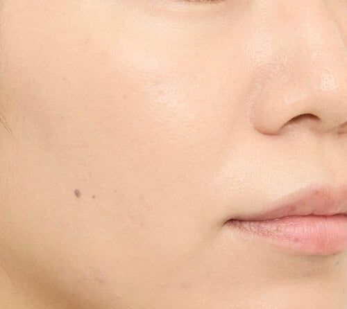 フィー「クッションエッグフィット カバー/03 Natural」を塗布した後の肌の画像