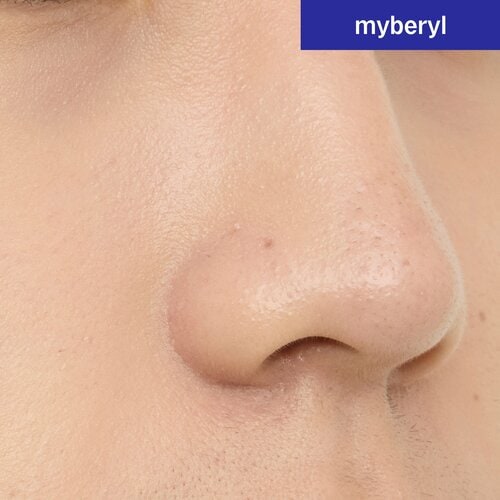 気になる部分を自然にカバー メンズBBクリームおすすめ イメージ