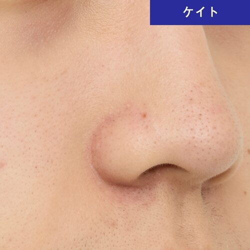 赤みは少し残るけど、テカリはそこそこ抑える メンズ向けフェイスパウダーおすすめ イメージ