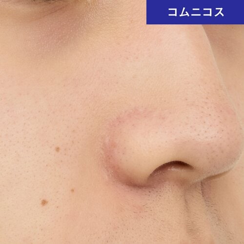 なめらか肌が手に入る メンズ向けフェイスパウダーおすすめ イメージ2