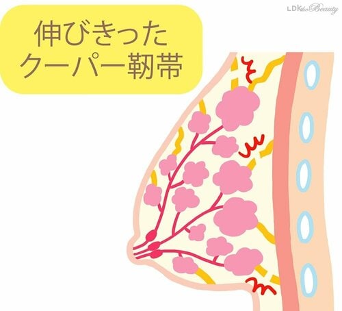 キホン1:筋力の衰えや姿勢の悪さ! 垂れの要因はさまざま バストケアおすすめ イメージ2