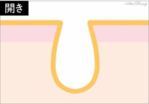 【開き】毛穴がぽっかり開いた状態 美容の裏ワザおすすめ イメージ