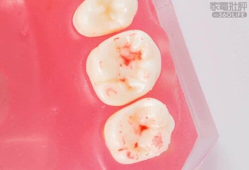 After 安い電動歯ブラシおすすめ イメージ