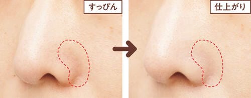 赤みの面影がまったくない! グリーンコンシーラーおすすめ イメージ
