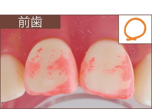 汚れ落ち：評価A イメージ