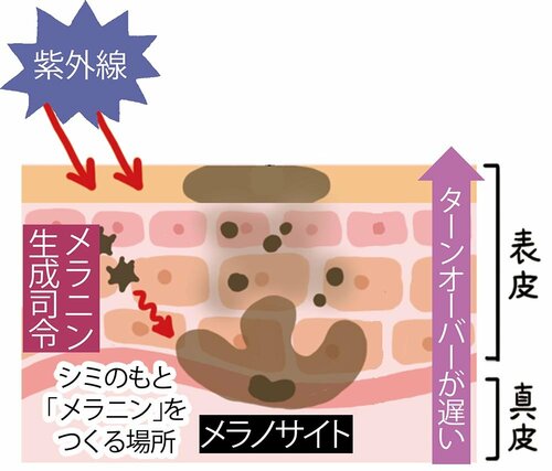 紫外線に反応してシミのもとが増加! イメージ