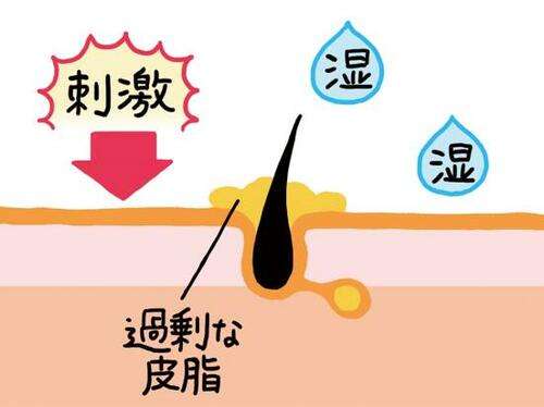 マスクによる肌荒れのメカニズムのイラスト画像
