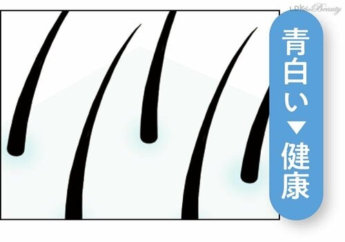 頭皮の色が髪の健康バロメーター イメージ