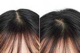 【正しいヘアケア】頭頂部の薄毛問題はジグザグ&朝のドライヤー｜『LDK』と専門家が解説