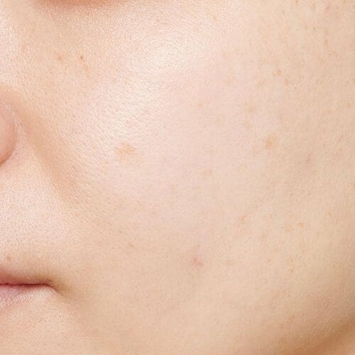 【仕上がり】シミは隠せるが毛穴カバーは苦手 美容誌ベスコスベースコスメおすすめ イメージ