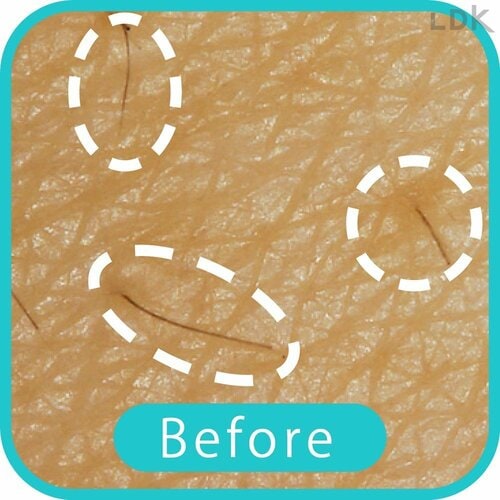 Before 女性用電気シェーバーおすすめ イメージ