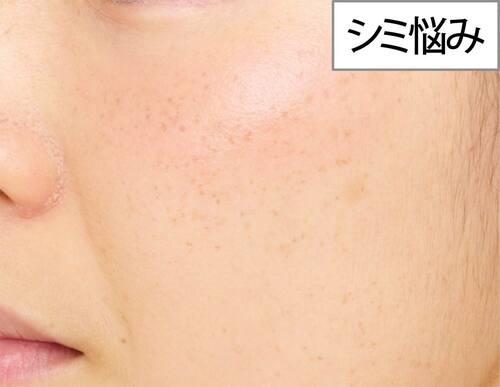 シミ悩みの仕上がり コンシーラーチークおすすめ イメージ