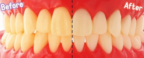 ホワイトニング力：ここまで色がかわります 紫歯磨き粉おすすめ イメージ