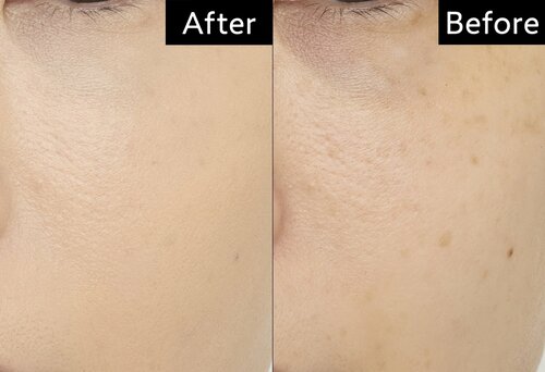 テスト1:カバー力 CCクリームおすすめ イメージ