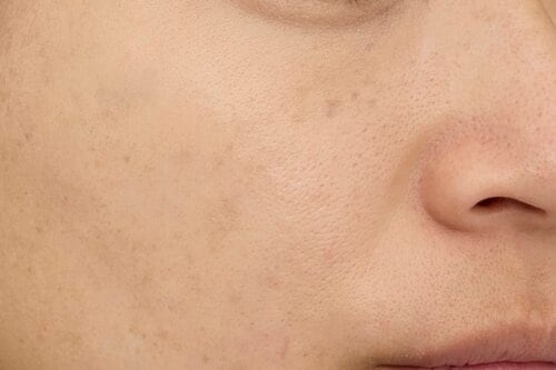 ナチュラルさ コンシーラーおすすめ イメージ