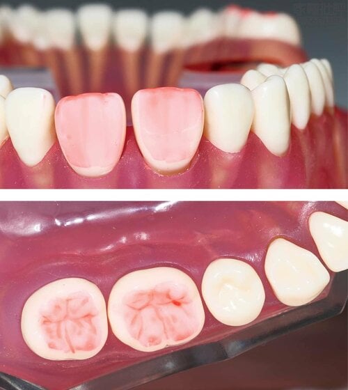 歯磨き前 家電批評ベストバイオブザイヤーおすすめ イメージ