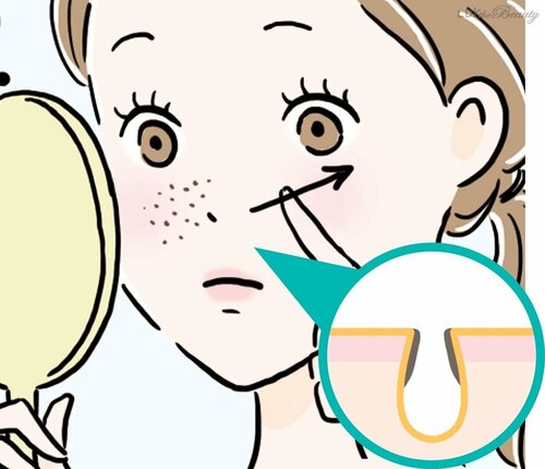 【メラニン毛穴】ザラつかないけどポツポツ黒い SNSでバズった毛穴ケアおすすめ イメージ