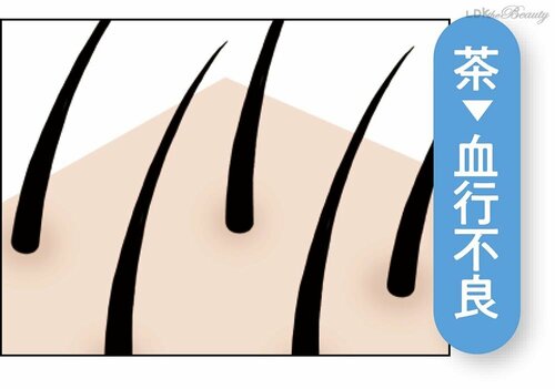 頭皮の色が髪の健康バロメーター イメージ5