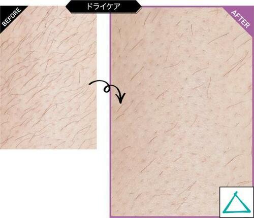 7位: 肌へのやさしさ、お手入れしやすさは優秀