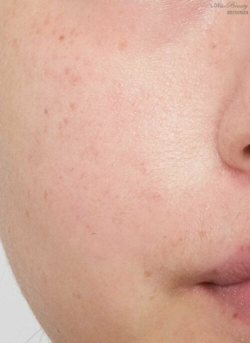 頬+小鼻に部分塗り LDK the Beautyインスタライブおすすめ イメージ