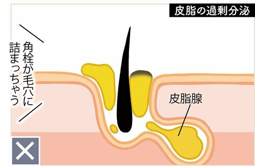 効果2:皮脂の分泌量を調整して詰まりにくくする ビタミンC美容液おすすめ イメージ