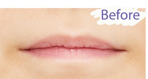 Before/色明るめの唇 ローズリップおすすめ イメージ
