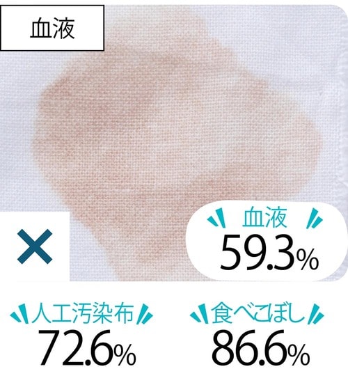 汚れ落ち:血液汚れは苦手かも 襟袖汚れ洗剤おすすめ イメージ