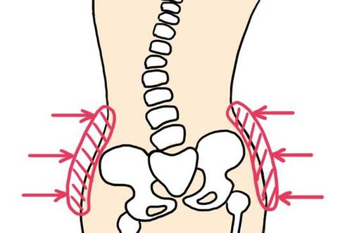 ソフトコルセットで姿勢を正せば腰痛改善に近づける！ イメージ