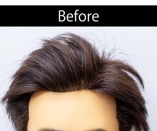 少し青めですが自然な仕上がり 増毛スプレーおすすめ イメージ