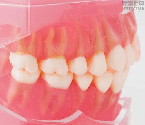 After 安い電動歯ブラシおすすめ イメージ