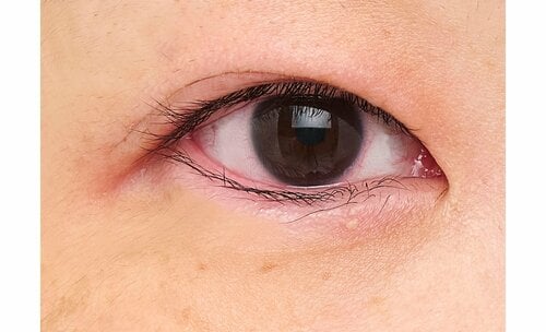 after アイプチおすすめ イメージ