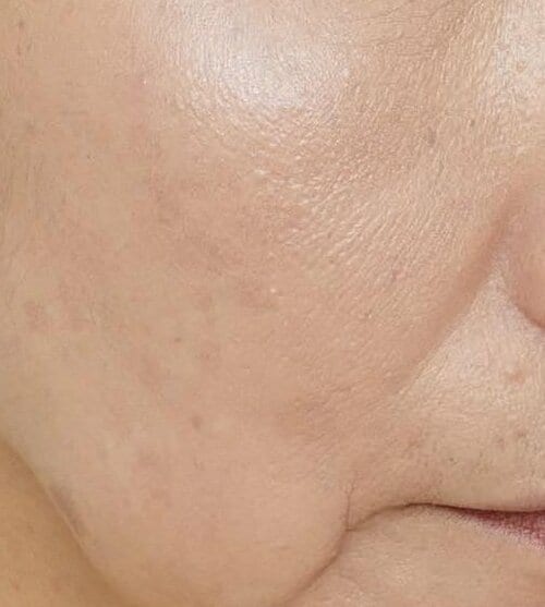ベージュとピーチを混ぜると血色感アップ 50代・60代向けハイライトおすすめ イメージ