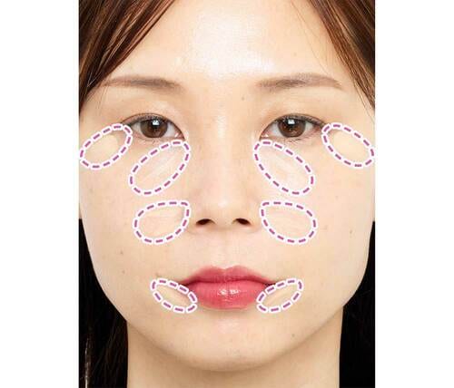 コンシーラーは顔の4カ所に効果的に入れる 青みピンクリップおすすめ イメージ