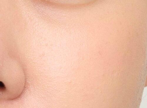 血色感・色味 韓国チークおすすめ イメージ