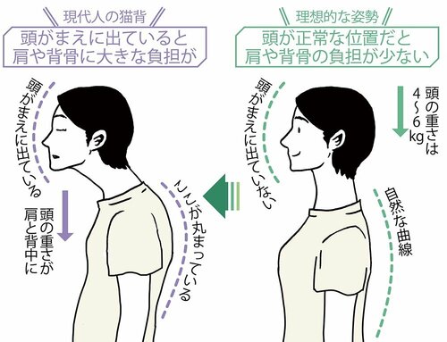 現状を知ろう! 現代人の姿勢と理想的な姿勢 イメージ