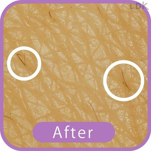 After VIOシェーバーおすすめ イメージ