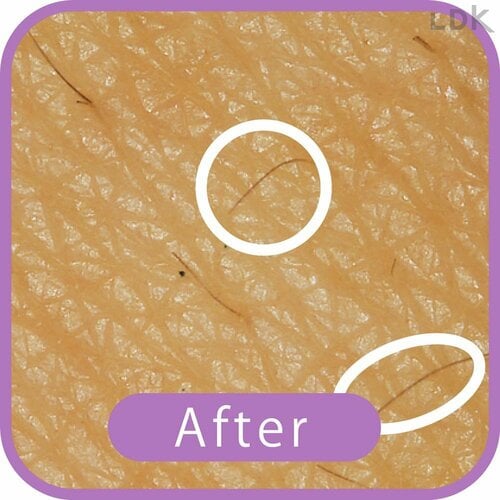 After VIOシェーバーおすすめ イメージ