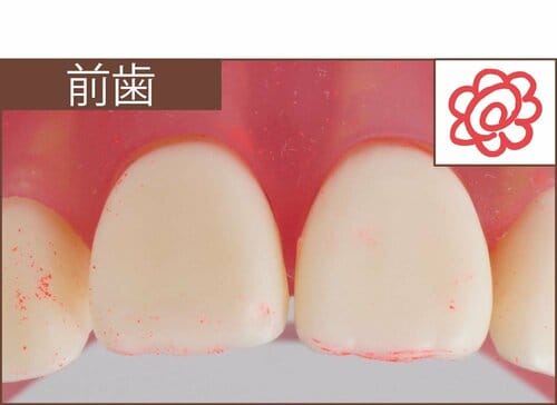 汚れ落ち：評価A イメージ