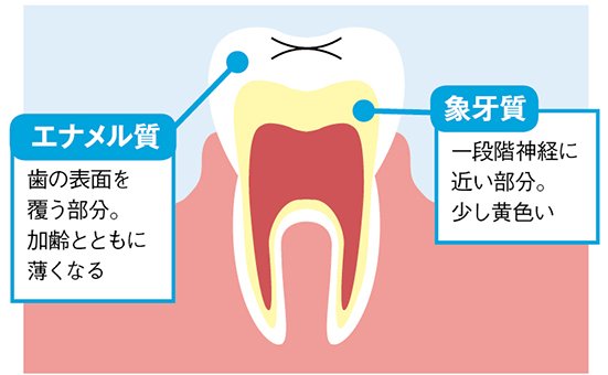 2種類の黄ばみのうち「内因性」に電動歯ブラシは効きません