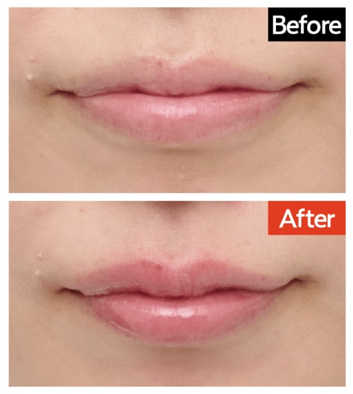 仕上がり：ちゅるんと感のあるツヤ リッププランパーおすすめ イメージ