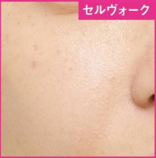 13位: 肌なじみバツグンで薄付きながらしっかりカバー ファンデーションおすすめ イメージ2