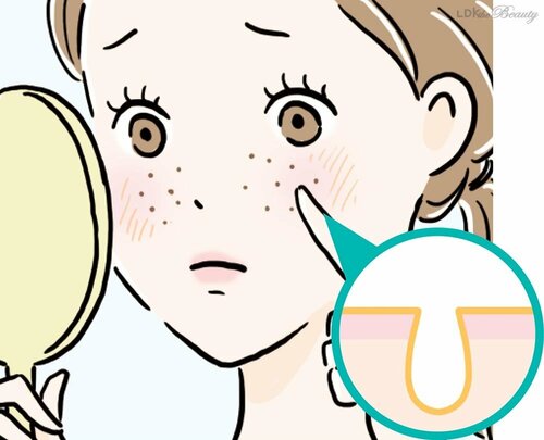 【開き毛穴】ベタつきと乾燥が混在している SNSでバズった毛穴ケアおすすめ イメージ