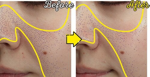 テスト2:シミケア度 ビタミンC美容液おすすめ イメージ