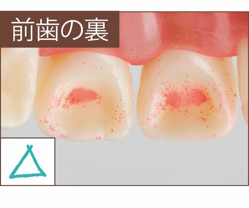 汚れ落ち:評価C こども用電動歯ブラシおすすめ イメージ