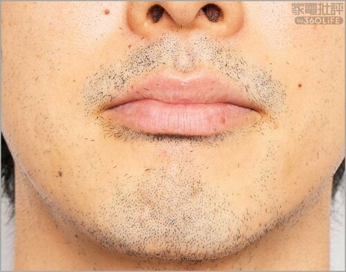 パナソニック「ラムダッシュ パームイン LITE」（3枚刃）：Before 家電批評ベストバイオブザイヤーおすすめ イメージ