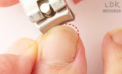 1:のびた角を切る 爪切りおすすめ イメージ