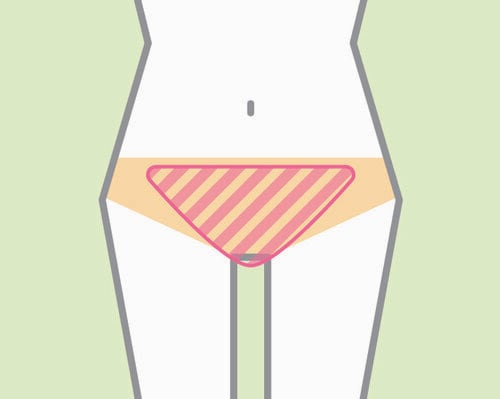 デリケートゾーンってどこ? デリケートゾーンクリームおすすめ イメージ