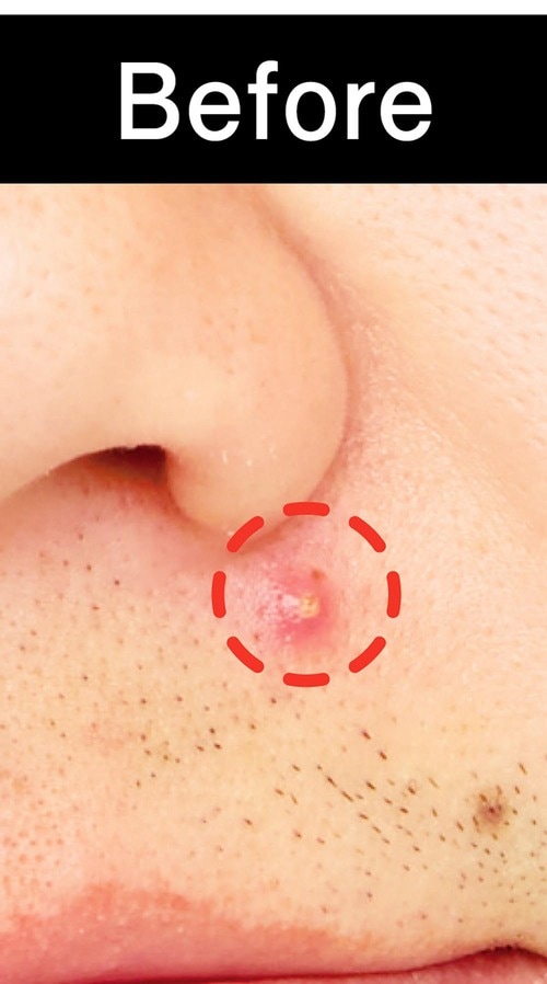 隠したいシミやニキビをナチュラルに補整! LDK the Beauty Menメンズコスメ大賞2025おすすめ イメージ3